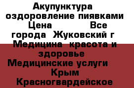 Акупунктура, оздоровление пиявками › Цена ­ 3 000 - Все города, Жуковский г. Медицина, красота и здоровье » Медицинские услуги   . Крым,Красногвардейское